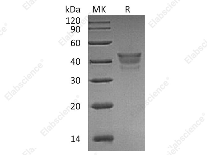 Recombinant Human METAP1 Protein - 1