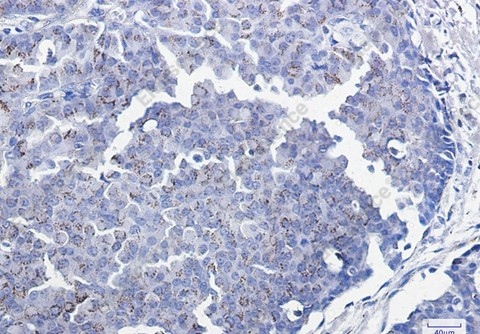 Recombinant Smad3 Monoclonal Antibody - 3