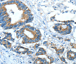 GLRA1 Polyclonal Antibody - 2