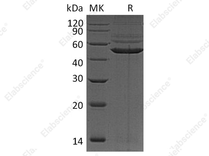 Recombinant Human PRKAR1A Protein (His Tag) - 1