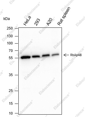 Recombinant RBBP4 Monoclonal Antibody - 1