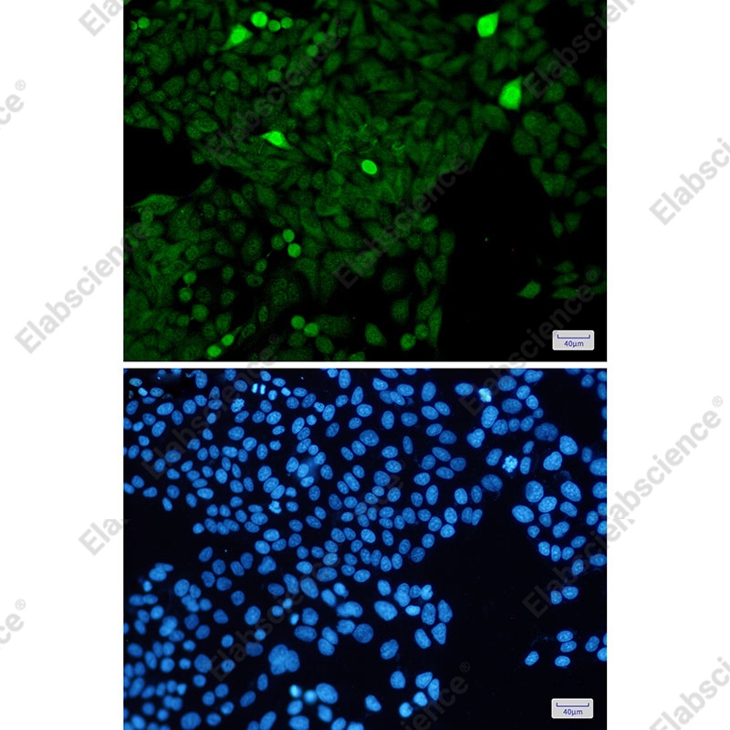 Recombinant Phospho-Histone H3 (Ser28) Monoclonal Antibody - 3
