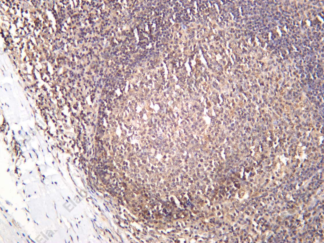 Recombinant Casein Kinase II α Monoclonal Antibody - 2