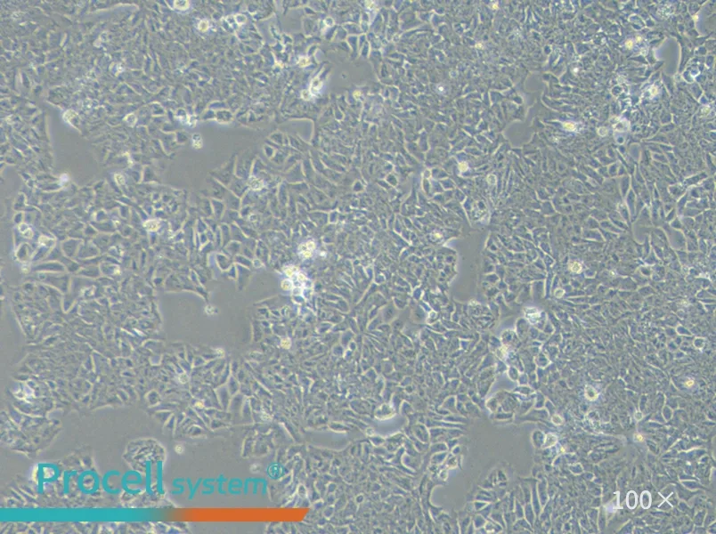 HCT-15 Cell Complete Medium - 3