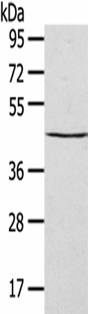 Western Blot analysis of HepG2 cells using SEPT2 Polyclonal Antibody at dilution of 1/400