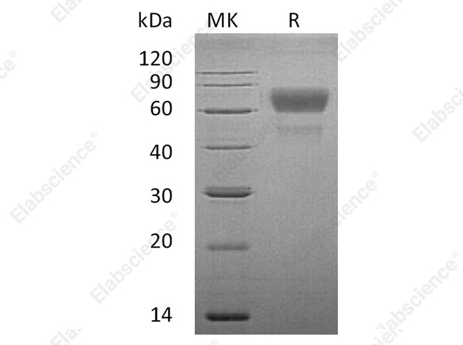 Recombinant Human CD28/TP44 Protein (Fc Tag) - 1