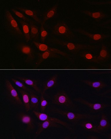 Immunofluorescence analysis of NIH/3T3 cells using SP1 Polyclonal Antibody at dilution of 1:50 (40x lens). Blue: DAPI for nuclear staining.