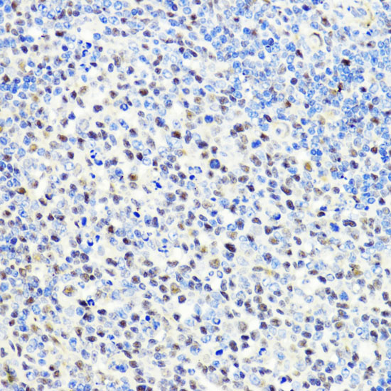 Immunohistochemistry of paraffin-embedded Rat spleen using CTCF Polyclonal Antibody at dilution of 1:100 (40x lens).