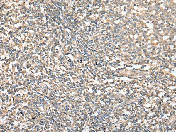 Immunohistochemistry of paraffin-embedded Human tonsil tissue  using CD1D Polyclonal Antibody at dilution of 1:25(?200)