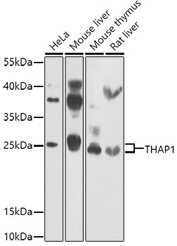 Western blot analysis of extracts of various cell lines using THAP1 Polyclonal Antibody at 1:1000 dilution.