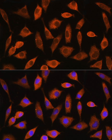 Immunofluorescence analysis of L929 cells using EIF2B4 Polyclonal Antibody at dilution of 1:100. Blue: DAPI for nuclear staining.