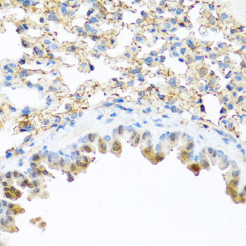 Immunohistochemistry of paraffin-embedded Mouse lung using PI3 Polyclonal Antibody at dilution of  1:100 (40x lens).