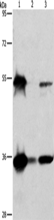 Western Blot analysis of Hela, K562 and Raji cell using BAG1 Polyclonal Antibody at dilution of 1:750