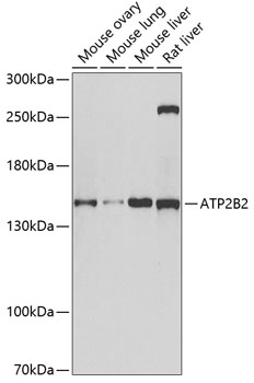 Western blot analysis of extracts of various cell lines using ATP2B2 Polyclonal Antibody at dilution of 1:1000.