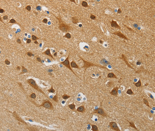 Immunohistochemistry of paraffin-embedded Human brain tissue using ATG4B Polyclonal Antibody at dilution 1:50