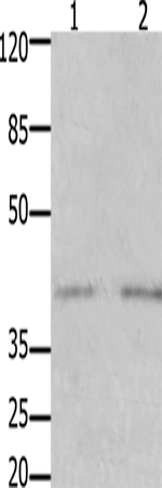 Western Blot analysis of Human fetal kidney and  brain tissue using GFRA3 Polyclonal Antibody at dilution of 1:1000