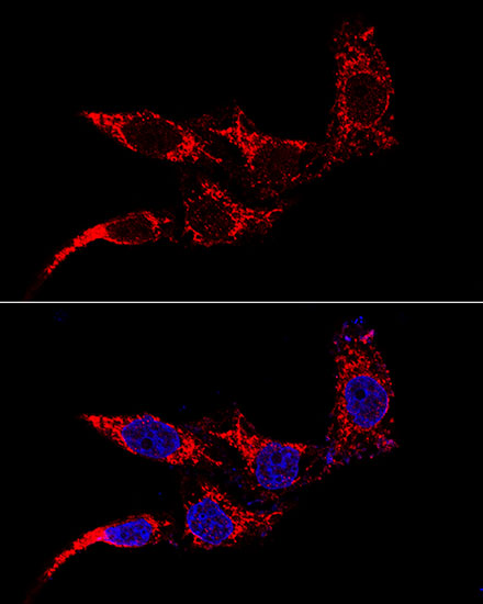 Confocal immunofluorescence analysis of HeLa cells using TTC11/FIS1 Polyclonal Antibody at dilution of 1:50 (60x lens). Blue: DAPI for nuclear staining.