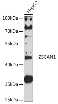 Western blot analysis of extracts of HepG2 cells using ZSCAN1 Polyclonal Antibody at 1:1000 dilution.