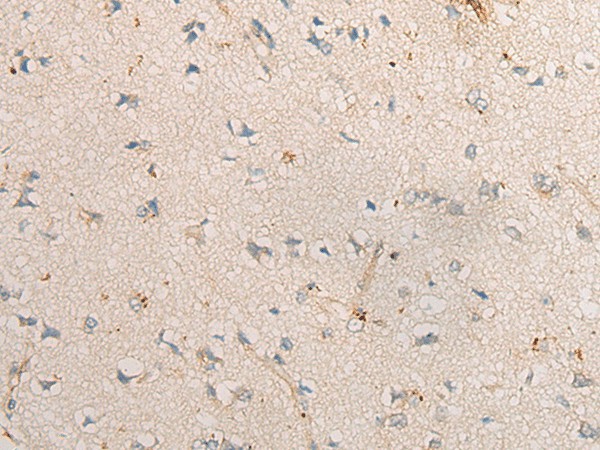 Immunohistochemistry of paraffin-embedded Human brain tissue  using PPM1D Polyclonal Antibody at dilution of 1:60(?200)