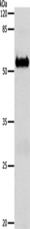 Western Blot analysis of Mouse brain tissue using SLC1A6 Polyclonal Antibody at dilution of 1:600