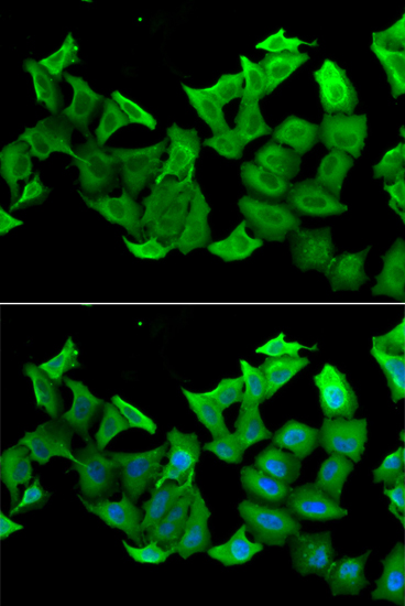 Immunofluorescence analysis of A549 cells using HAGH Polyclonal Antibody Blue: DAPI for nuclear staining.