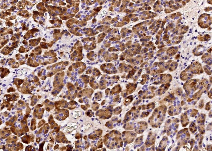 Recombinant REG1B Monoclonal Antibody-searchlist-1
