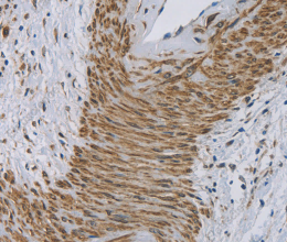 Cytochrome b5 Polyclonal Antibody - 3