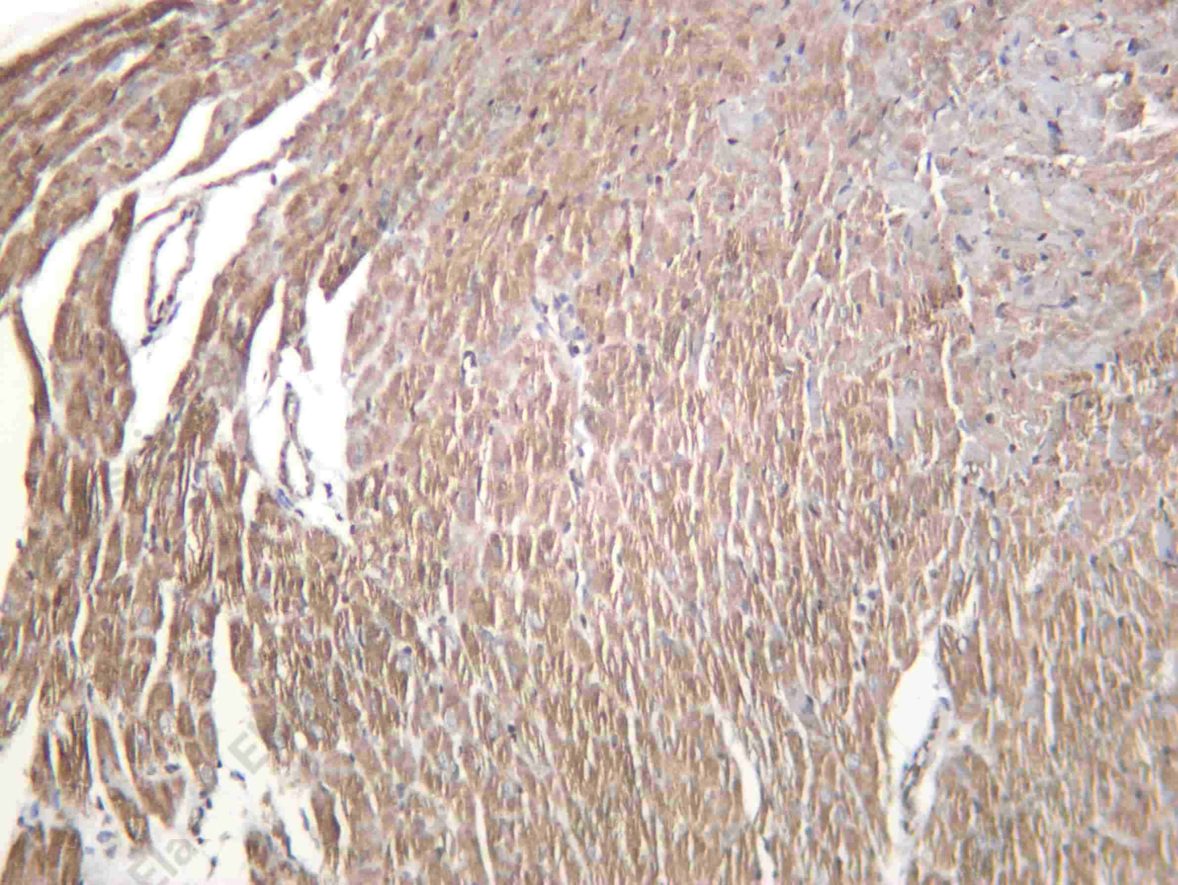 Recombinant OGDH Monoclonal Antibody - 2