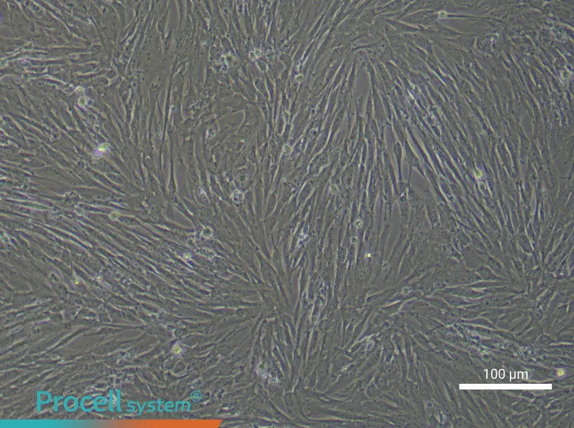 Human Lung Fibroblast Complete Medium - 2