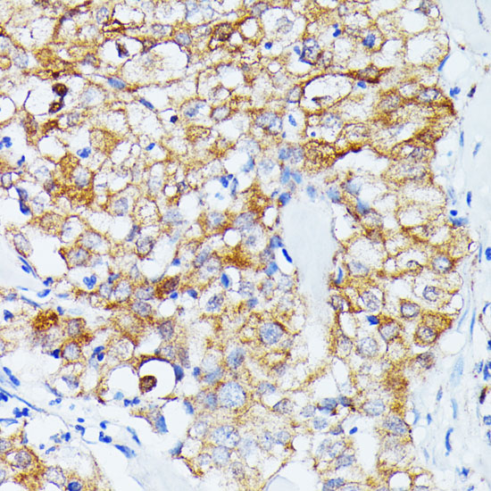 ECE1 Polyclonal Antibody - small - 2