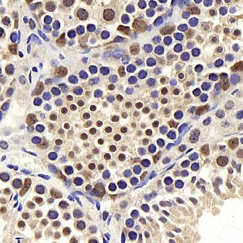 Immunohistochemistry analysis of paraffin-embedded mouse testis  using BRAF Polyclonal Antibody at dilution of 1:400.