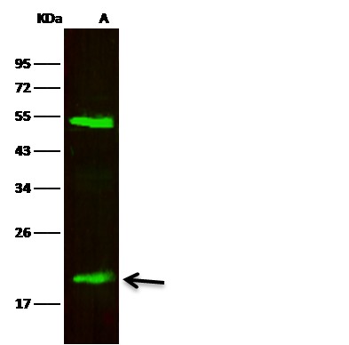 Recombinant LCN2/NGAL Monoclonal Antibody-searchlist-1