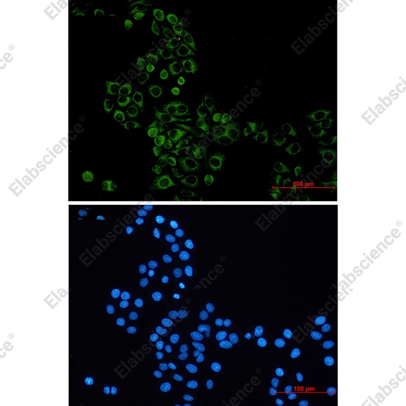 Recombinant GBP1 Monoclonal Antibody - 2