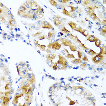 Immunohistochemistry of paraffin-embedded Human stomach using CCL21 Polyclonal Antibody at dilution of 1:100 (40x lens).