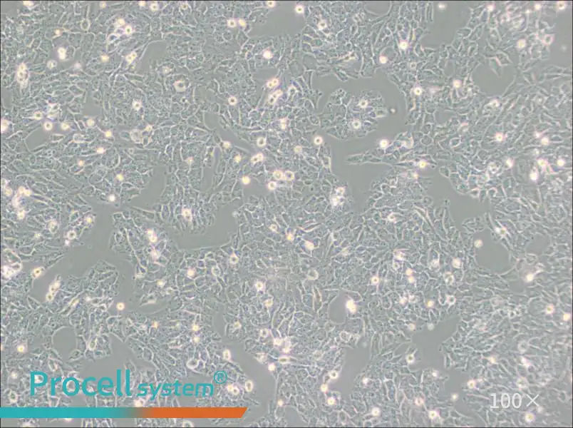 SK-N-AS Cell Complete Medium - 1