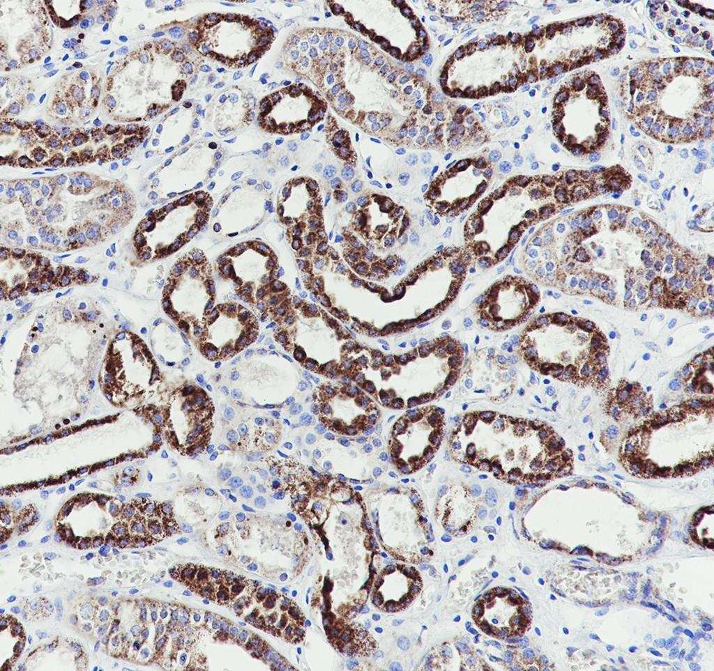 Recombinant SUCLG1 Monoclonal Antibody - small - 4