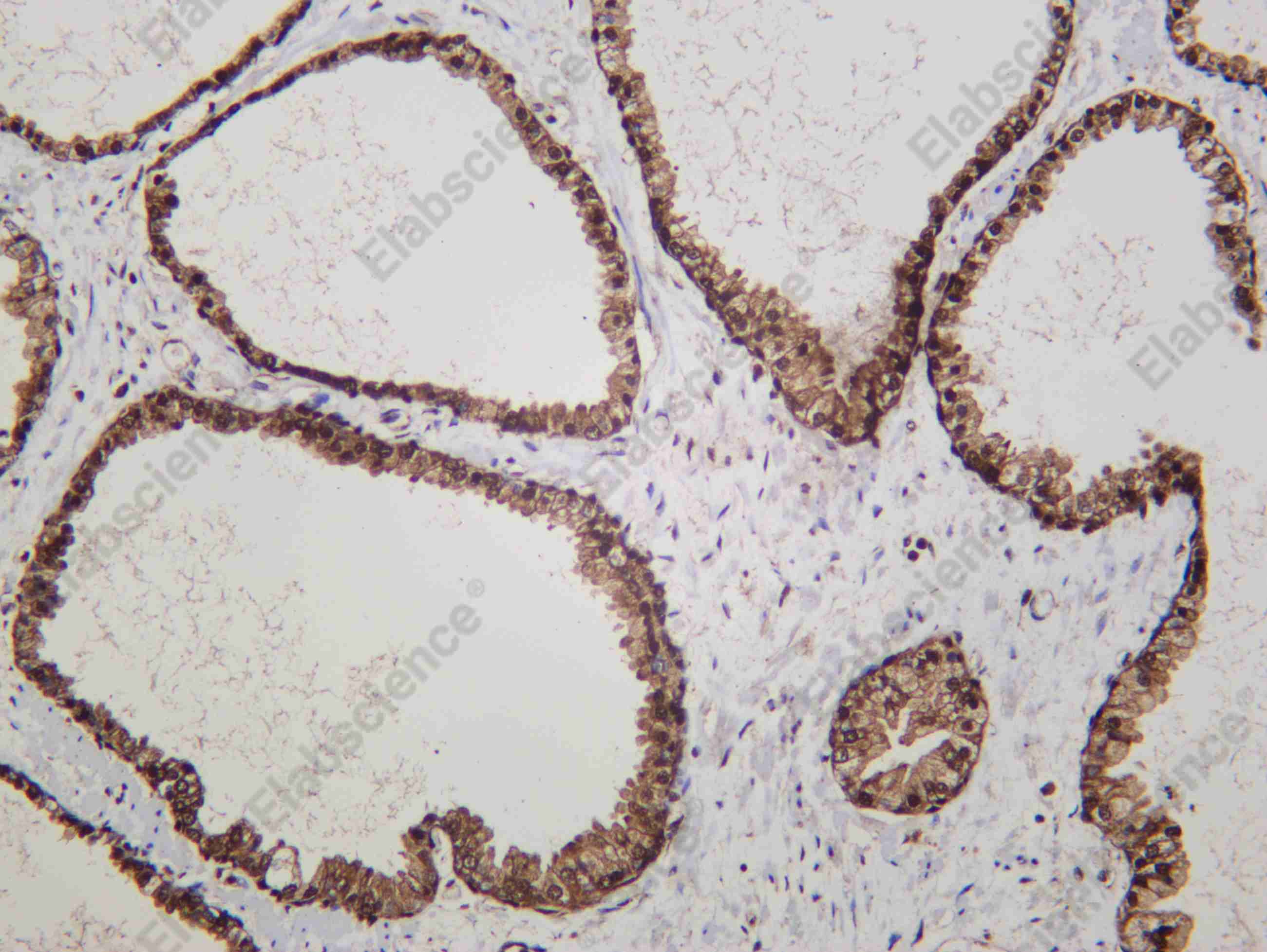 Recombinant BMX Monoclonal Antibody - 1
