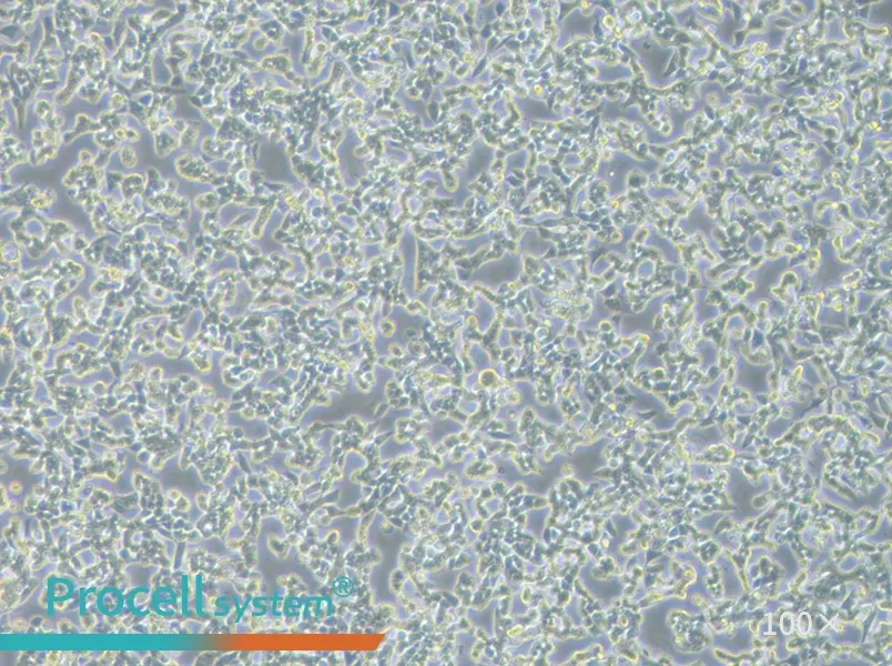 RL95-2 Cell Complete Medium - 1