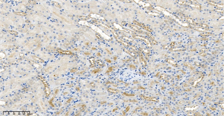 Recombinant Keap1 Monoclonal Antibody - 2