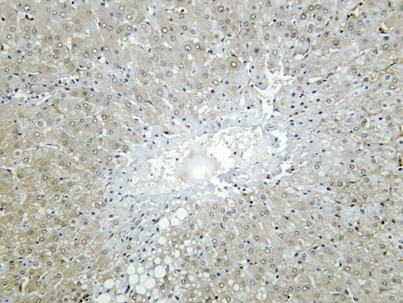 Recombinant HGF Monoclonal Antibody - 2