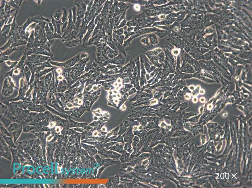 Y1 [Y-1] Cell Complete Medium - 5