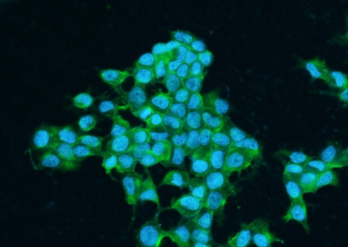 Recombinant IGF1R/CD221 Monoclonal Antibody - small - 2