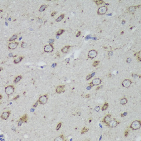 Immunohistochemistry of paraffin-embedded Rat brain using PSAP Polyclonal Antibody at dilution of  1:200 (40x lens).