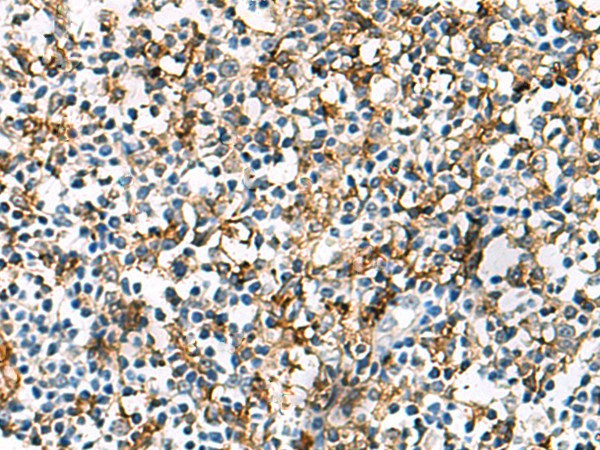 Immunohistochemistry of paraffin-embedded Human tonsil tissue  using HLA-DRA Polyclonal Antibody at dilution of 1:30(?200)