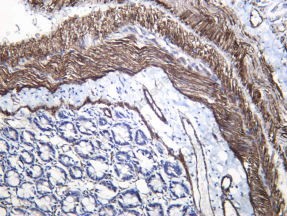 Recombinant Myosin Heavy Chain, Smooth Muscle (SMMHC) Monoclonal Antibody - 4