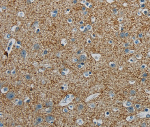 Immunohistochemistry of paraffin-embedded Human brain tissue using PGLYRP1 Polyclonal Antibody at dilution 1:40