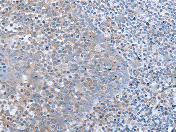 Immunohistochemistry of paraffin-embedded Human tonsil tissue  using ZIC1 Polyclonal Antibody at dilution of 1:65(?200)