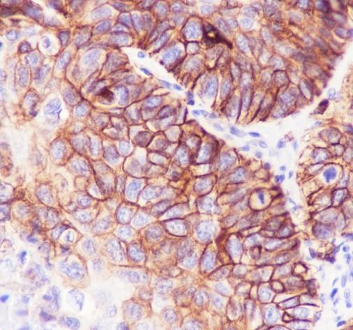 Recombinant SLC7A5/LAT1 Monoclonal Antibody - small - 2