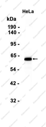 Recombinant AMPK alpha 1/2 Monoclonal Antibody - 2