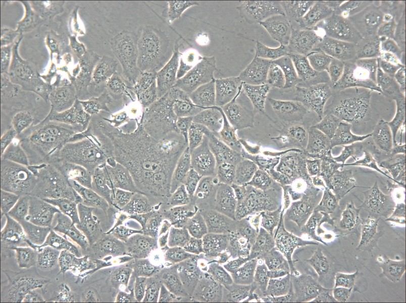 NCI-H1693 Cell Complete Medium - small - 5